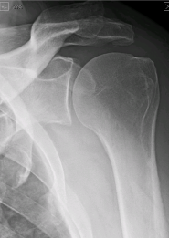 anatomy and function of shoulder